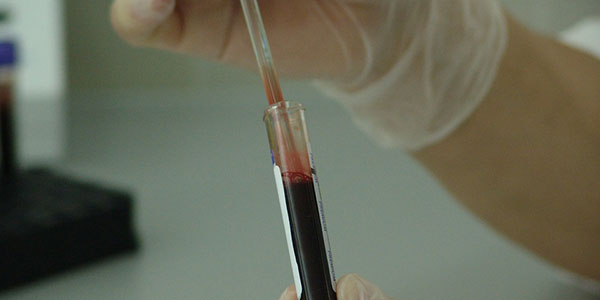 Blood Test